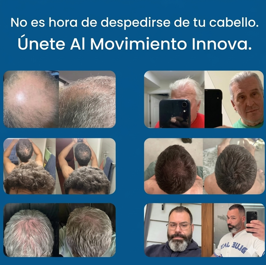 Kit Péptidos Microinfusión Crecimiento del Cabello Innova®